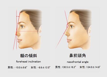 顔の傾斜（forehead inclination） 男性：-10.0±9.6° 女性：-6.6±12.0°／鼻前頭角（nasofrontal angle） 男性：130.5±16.2° 女性：134.0±14.8°