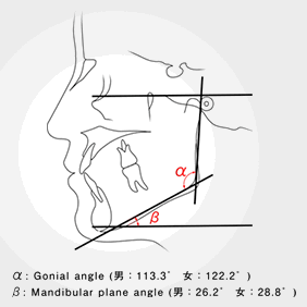 α：Gonial angle（男：113.3°　女：112.2°）／β：Mandibular plane angle（男：26.2°　女：28.8°）