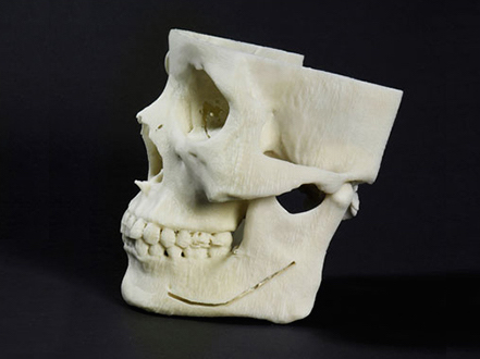 3次元実体模型  computer-based 3D skull model 